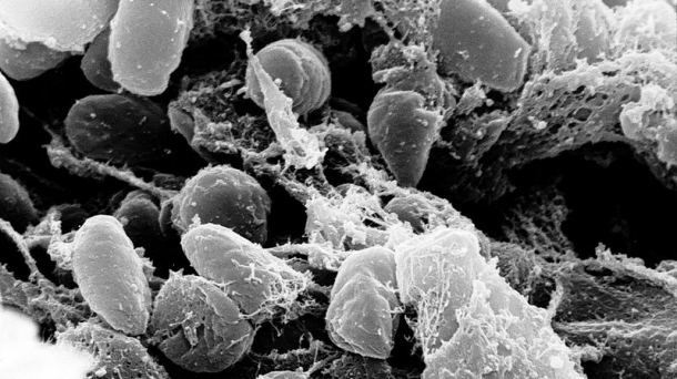 Historia de la peste bubónica y Mujeres con ciencia
