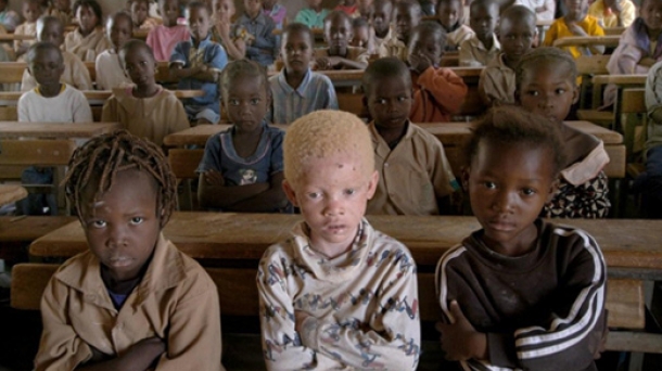 Crema protectora para albinos en África y pintura para Mal de Chagas