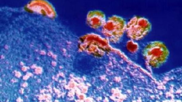 Ciencia: Montagnier, Gallo y la historia del SIDA