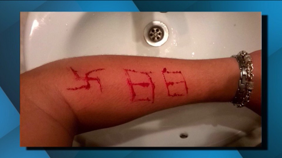 Heridas de los neonazis al joven bilbotarra.