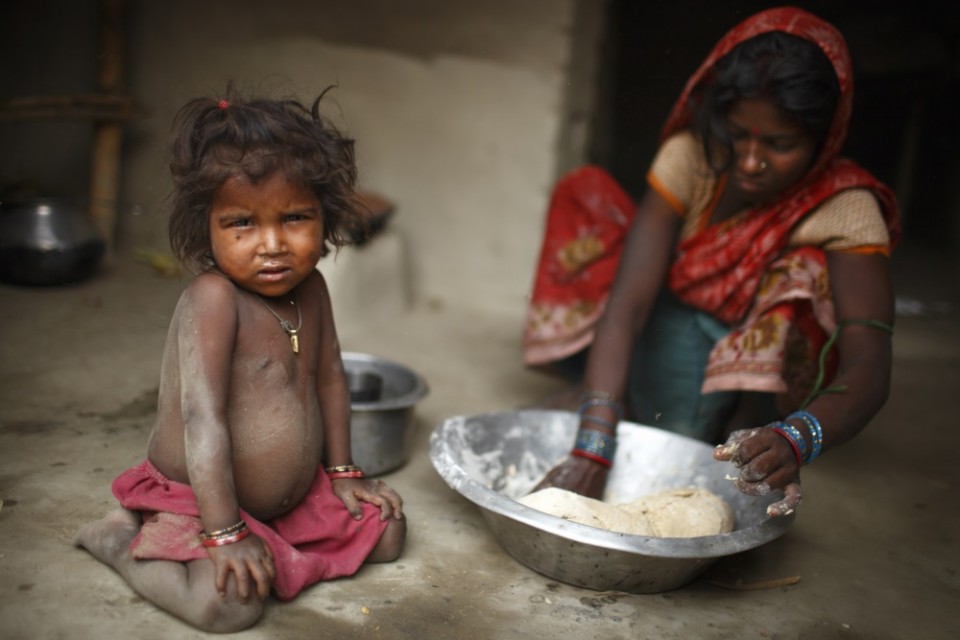 La desnutrición está detrás de la mitad de las muertes de menores de 5 años del mundo. Foto: UNICEF
