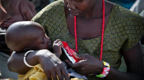 Hambruna en Sudán del sur: más de un millón de niños nos necesitan.