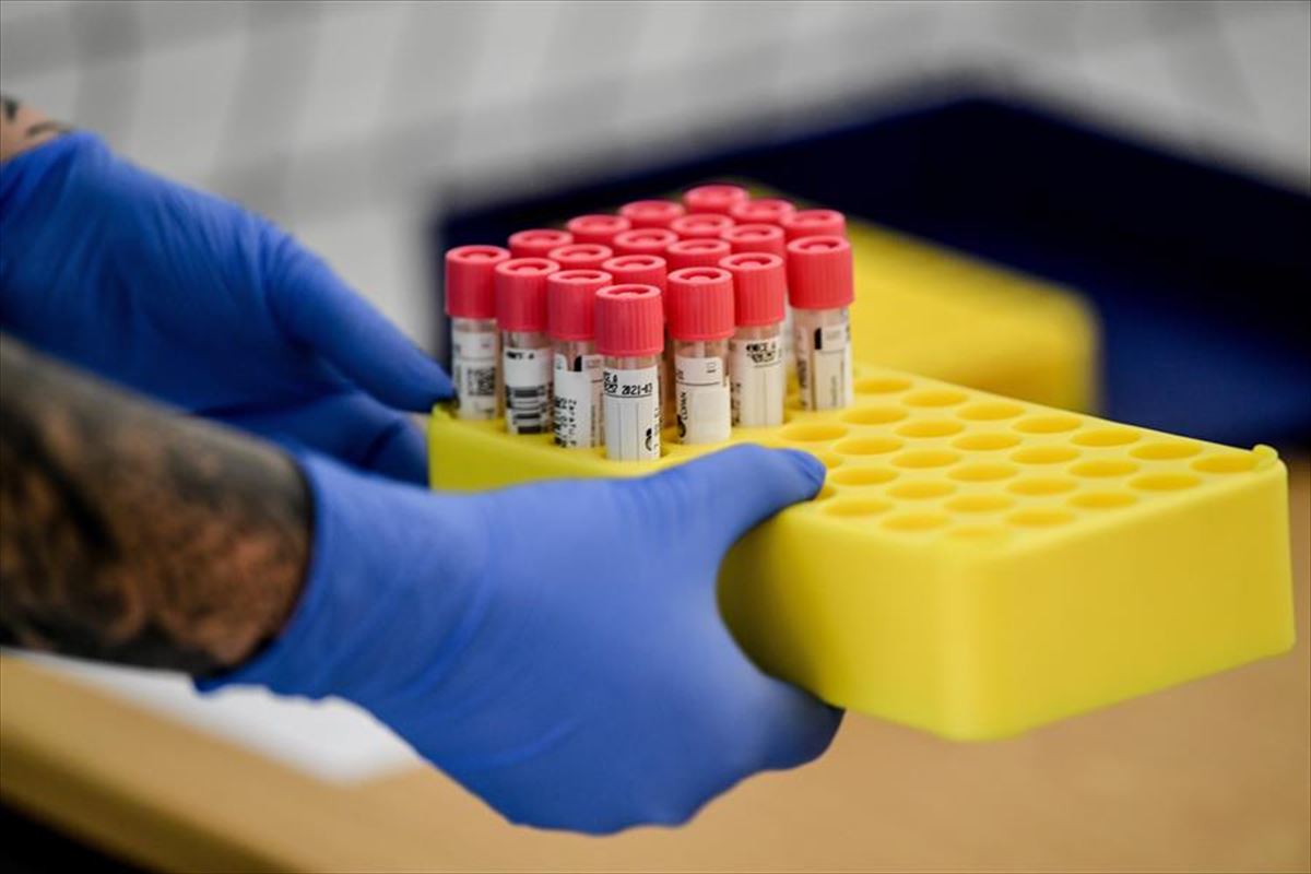 Varias muestras de pruebas realizadas para detectar el coronavirus. 