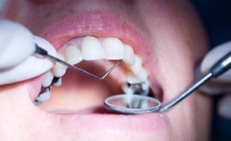 Venganza exnovia | Una dentista saca todos los dientes a su exnovio