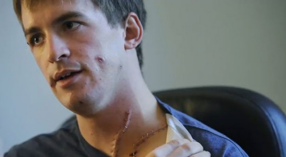 Stephen Barton, víctima del tiroteo de Denver, muestra sus cicatrices en un vídeo. Foto: YouTube