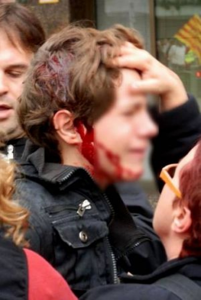 13 urteko mutil bat zauritu da Tarragonan, Mossoen karga batean. (2012-11-14)