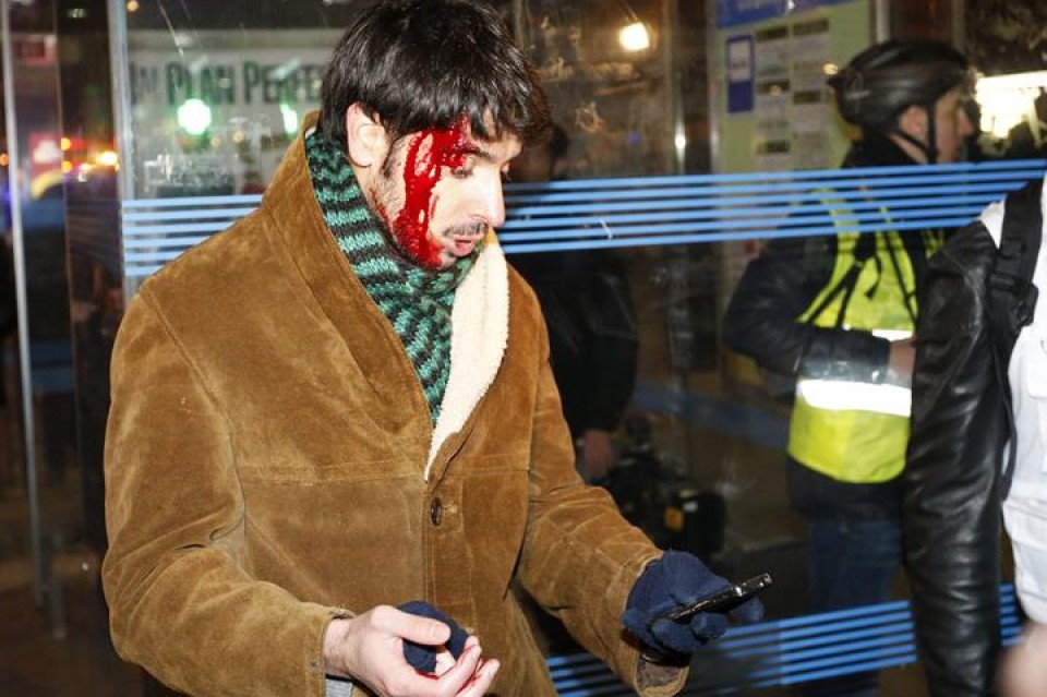 Un periodista herido. EFE