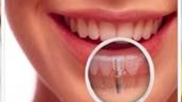 Peligroso mercurio en la boca 