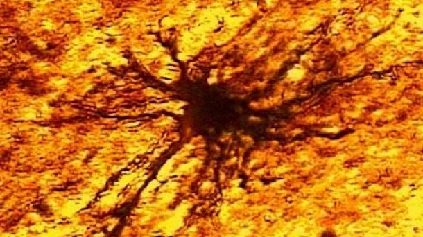Ciencia: los astrocitos, las nannys del cerebro