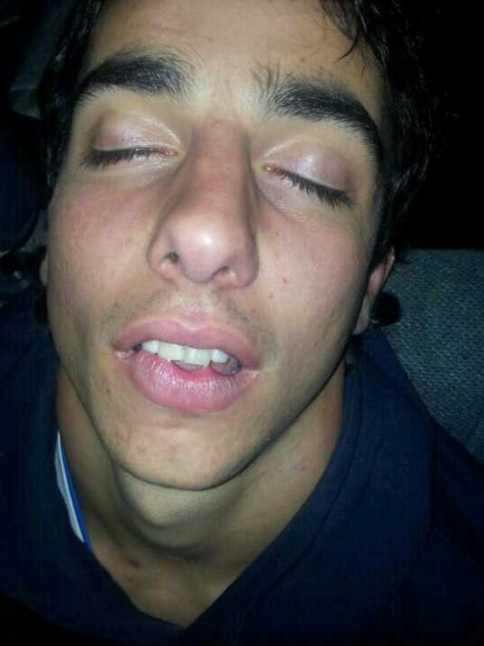 Dida Fresh lehiaketa: Itsusiak