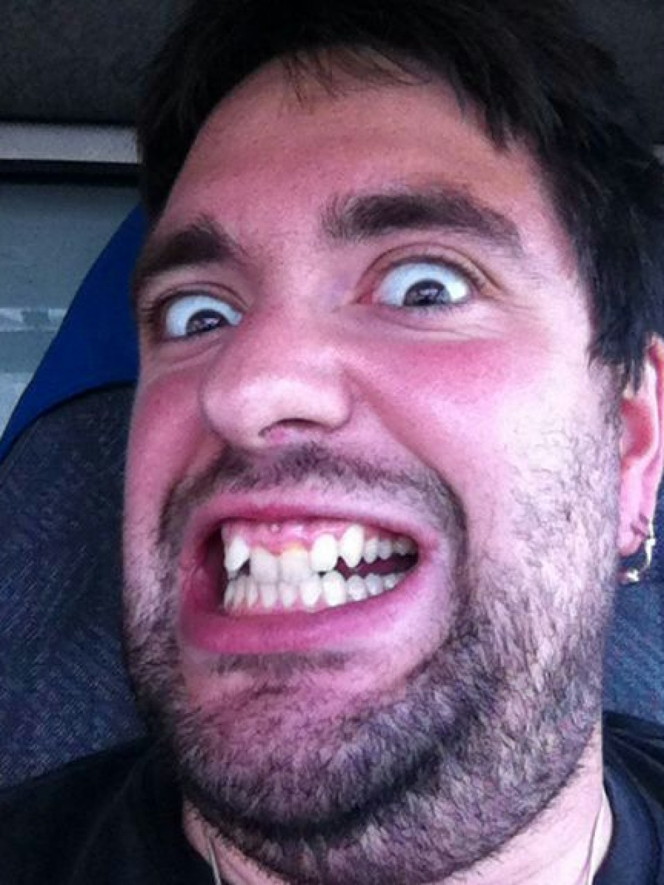 Dida Fresh lehiaketa: Itsusiak