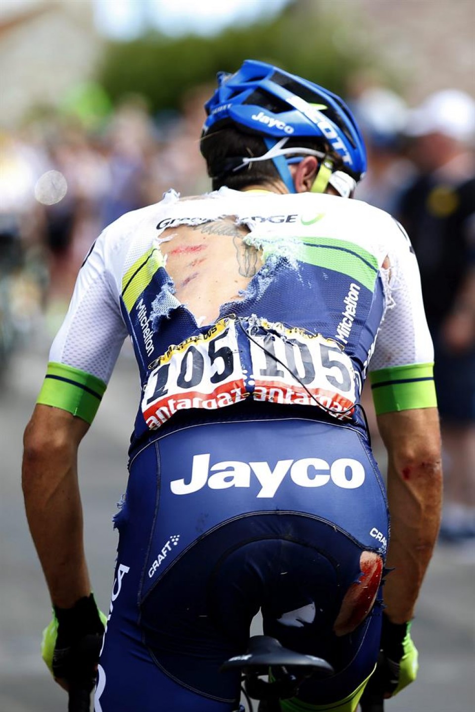 Matthews, tras sufrir una caída en la 3ª etapa