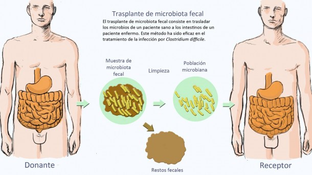 Alterar la microbiota intestinal mejora los síntomas del lupus