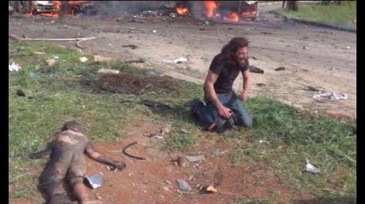 Abd Alkader Habak, fotógrafo sirio tras el atentado con coche bomba