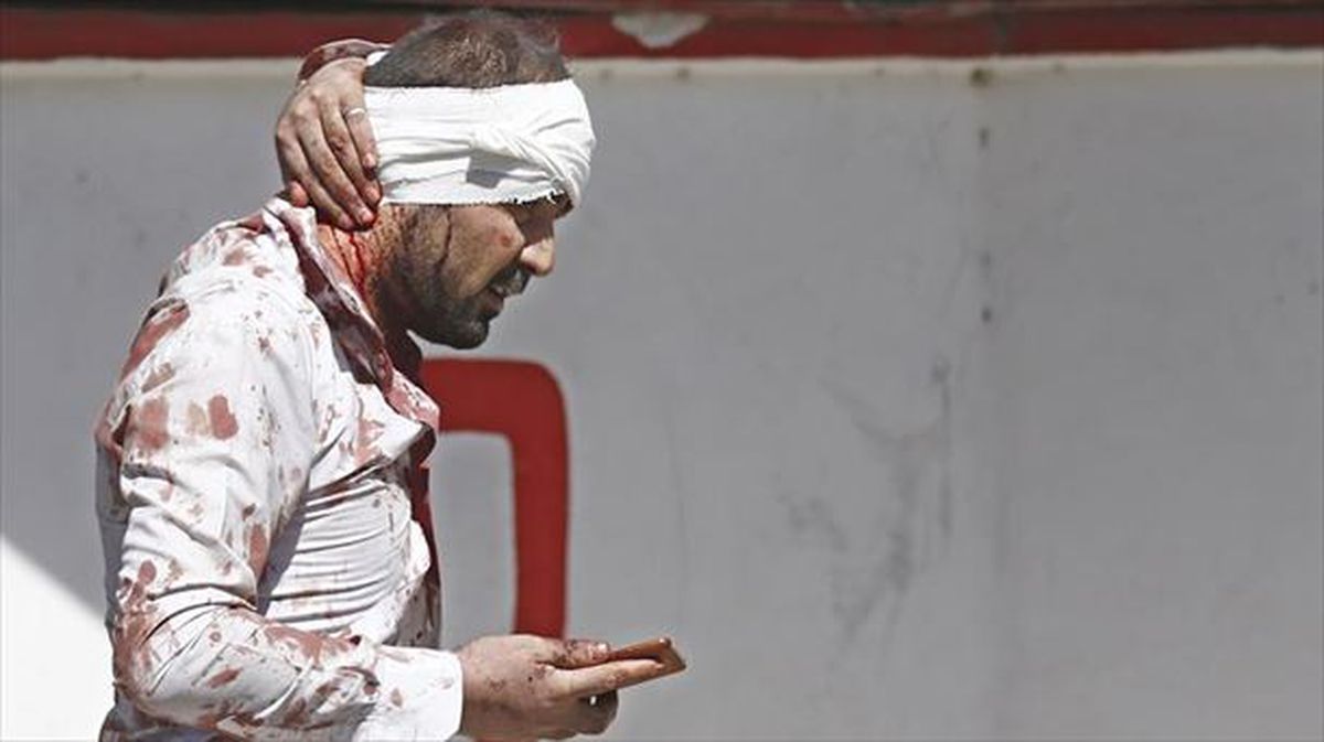 Un herido reacciona tras el atentado. Foto: EFE