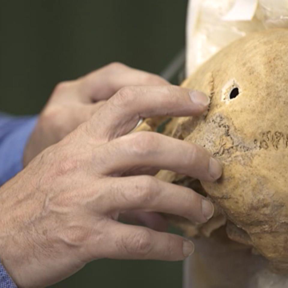 Cráneo de un asesinado durante la Guerra Civil