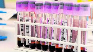 Detenidos seis destacados atletas en una operación contra el dopaje deportivo