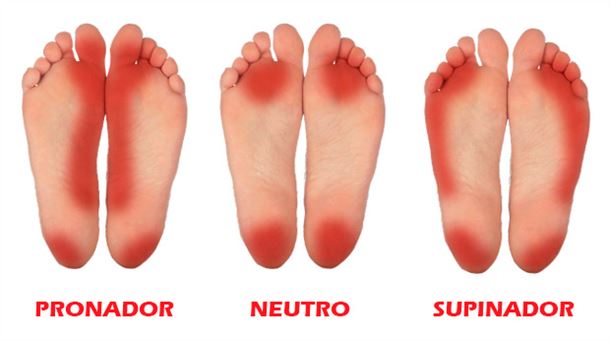 Distintos tipos de pisada