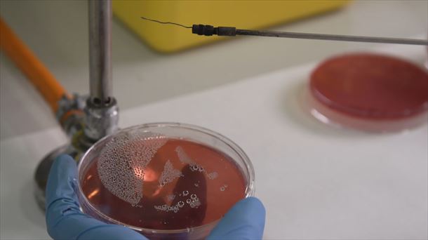 Bakterio erresistenteekin egindako laborategi proba bat.