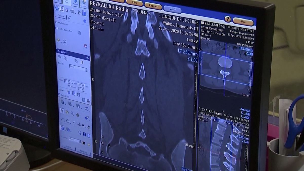 Análisis mediante radiografía. Foto: EiTB