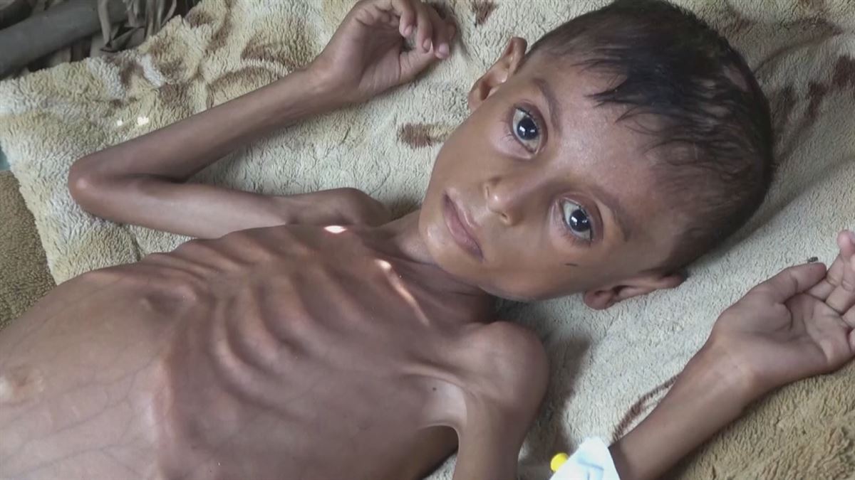 La ONU alerta de que Yemen se encuentra al borde de la hambruna