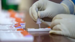 Covidaren FLiRT aldaeraren hainbat kasu atzeman ditu Osakidetzak EAEn