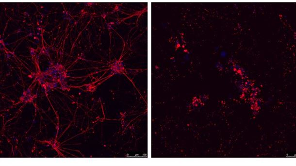 Neuronas motoras de ratón expuestas(dcha) o no (izda) a los péptidos asociados a la ELA. CNIO.