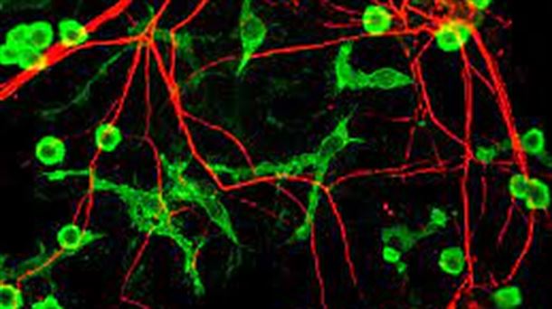 ¿Cómo limpia el cerebro las neuronas muertas? y bioleds: luz con proteínas 