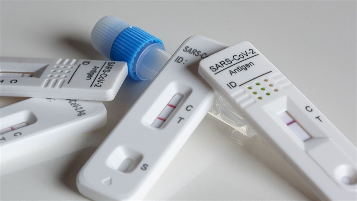 Test comunes para la detección del coronavirus. Foto: pixabay