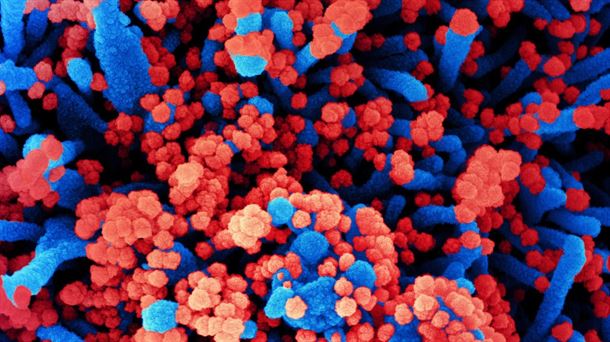 Micrografía de células humanas (azul) infectadas con SARS-CoV-2 (rojo)/NIH
