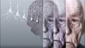 Ser cuidadora de un enfermo de alzheimer 