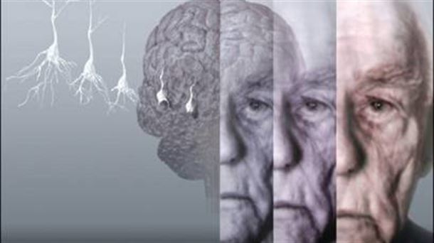Ser cuidadora de un enfermo de alzheimer "es duro, muy duro"