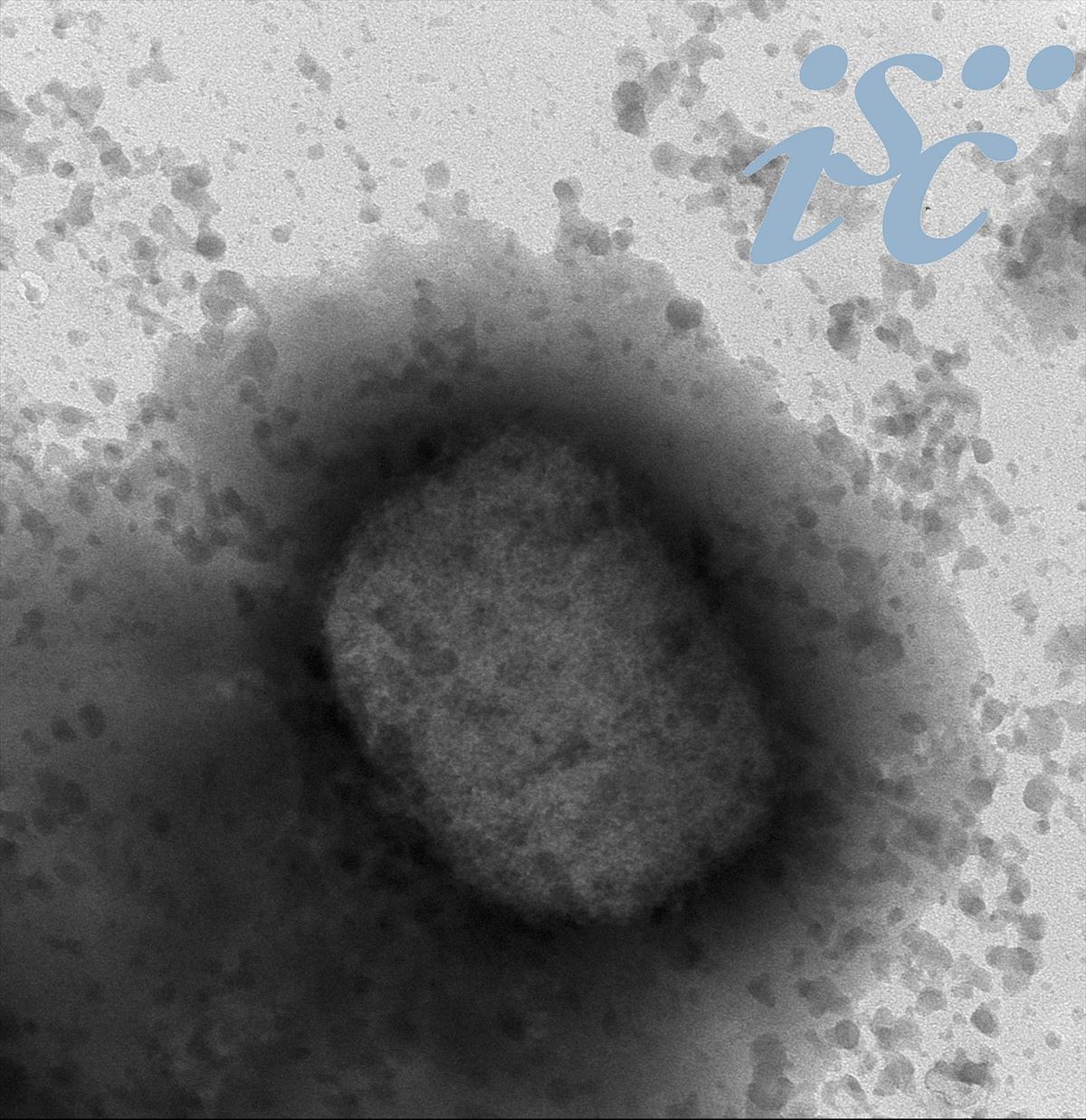 Virus de la viruela del mono por microscopía electrónica, facilitada por el Instituto de Salud Carlos III (ISCIII).