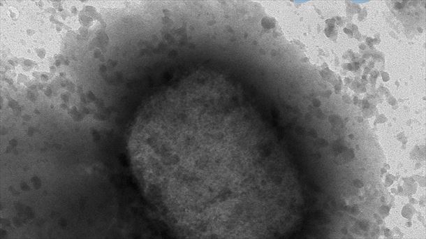 El virus de la viruela del mono en un microscopio. Foto de archivo: EFE