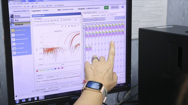 Una investigadora muestra la secuencia completa de la viruela del mono