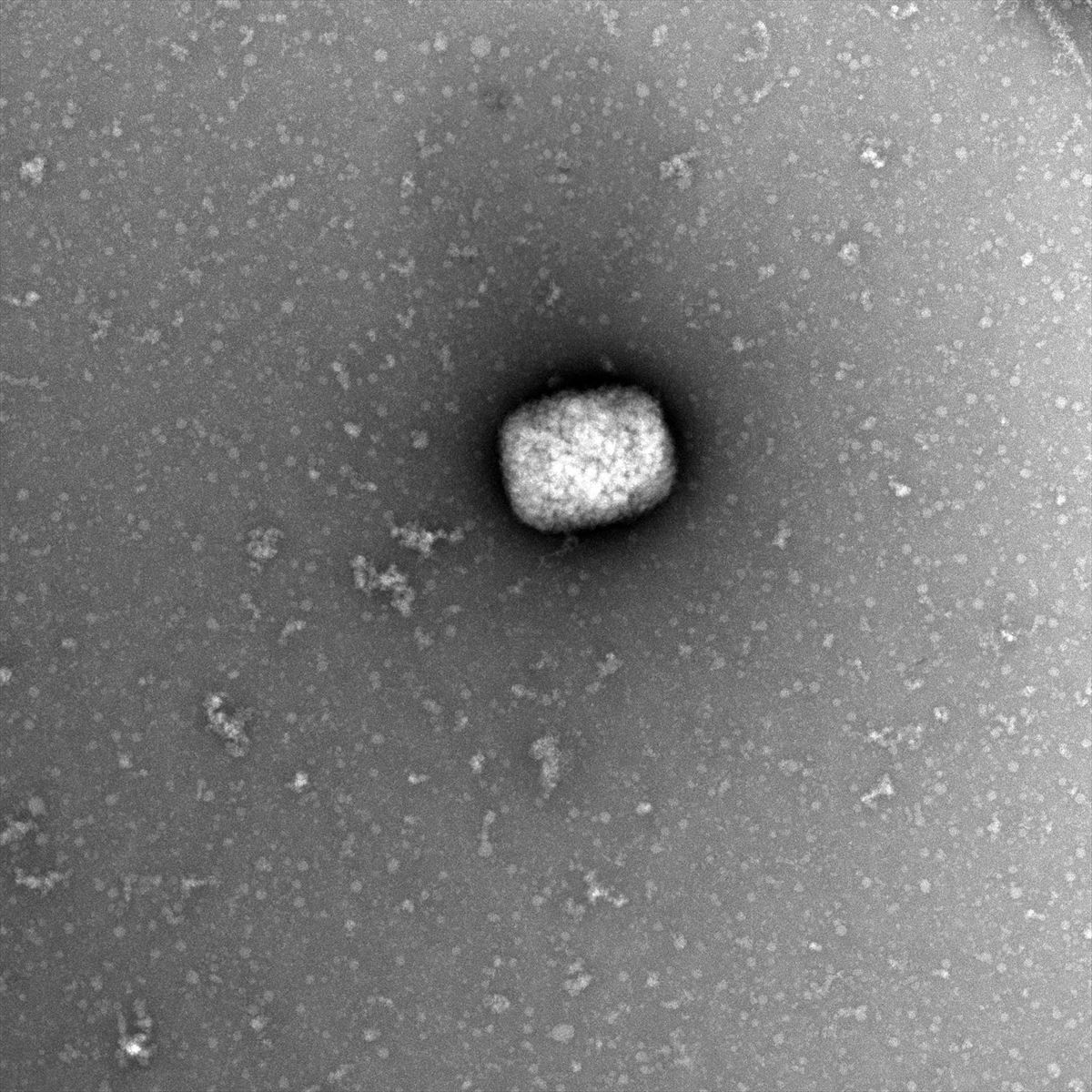 Vista microscópica de partículas virales de la viruela del mono. 