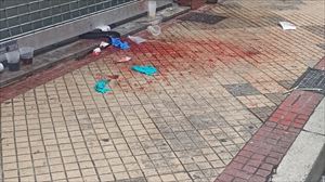 Gizon bat oso larri zauritu dute arma zuriz egindako eraso batean, Gasteizen 