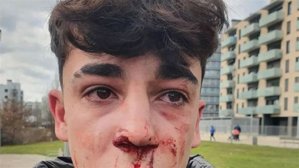 Imagen del joven que denuncia haber sido golpeado por la Policía Municipal de Vitoria. Foto: EITB