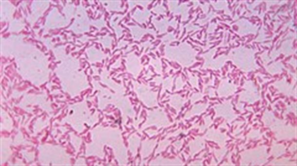 Un test de microbiota detecta pólipos y cáncer colorrectal. La Gran Mancha Roja de Júpiter tiene 190 años