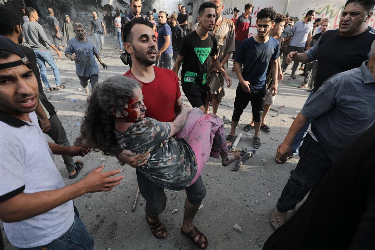 Menor herida por los bombardeos israelíes en Gaza. Foto: Efe