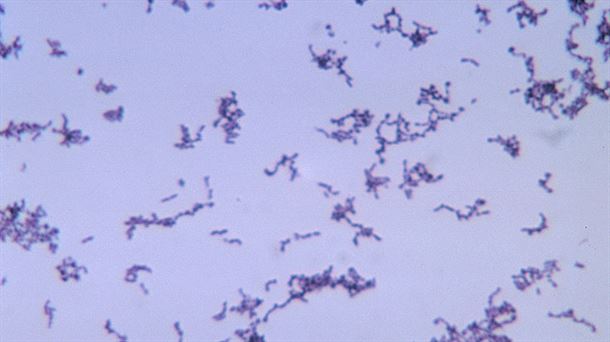 La bacteria, al microscopio. Wikipedia