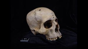 Descubren en un cráneo egipcio de más de 4.000 años indicios de cirugía contra el cáncer