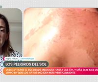 Ingrid Hiltun, dermatóloga: ''El sol causa cáncer de piel y envejecimiento''