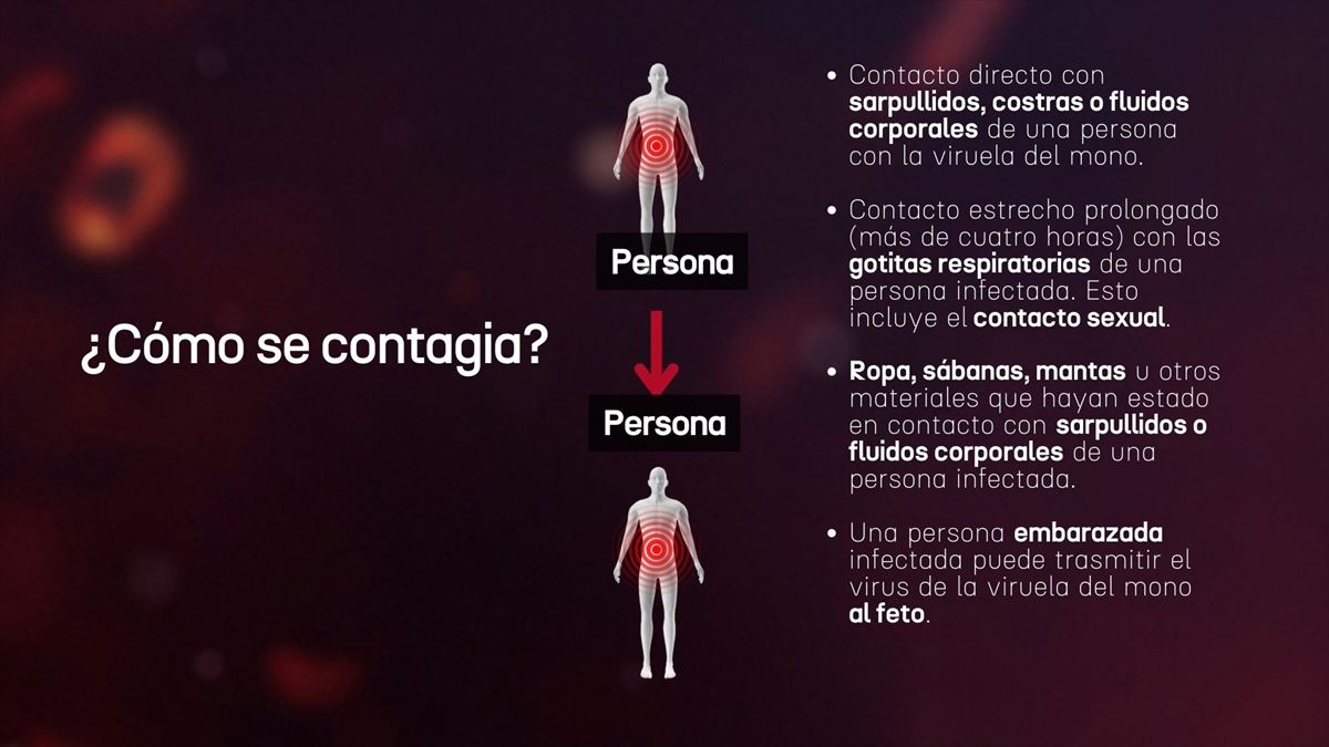 Contagio del mpox. Imagen: Canva