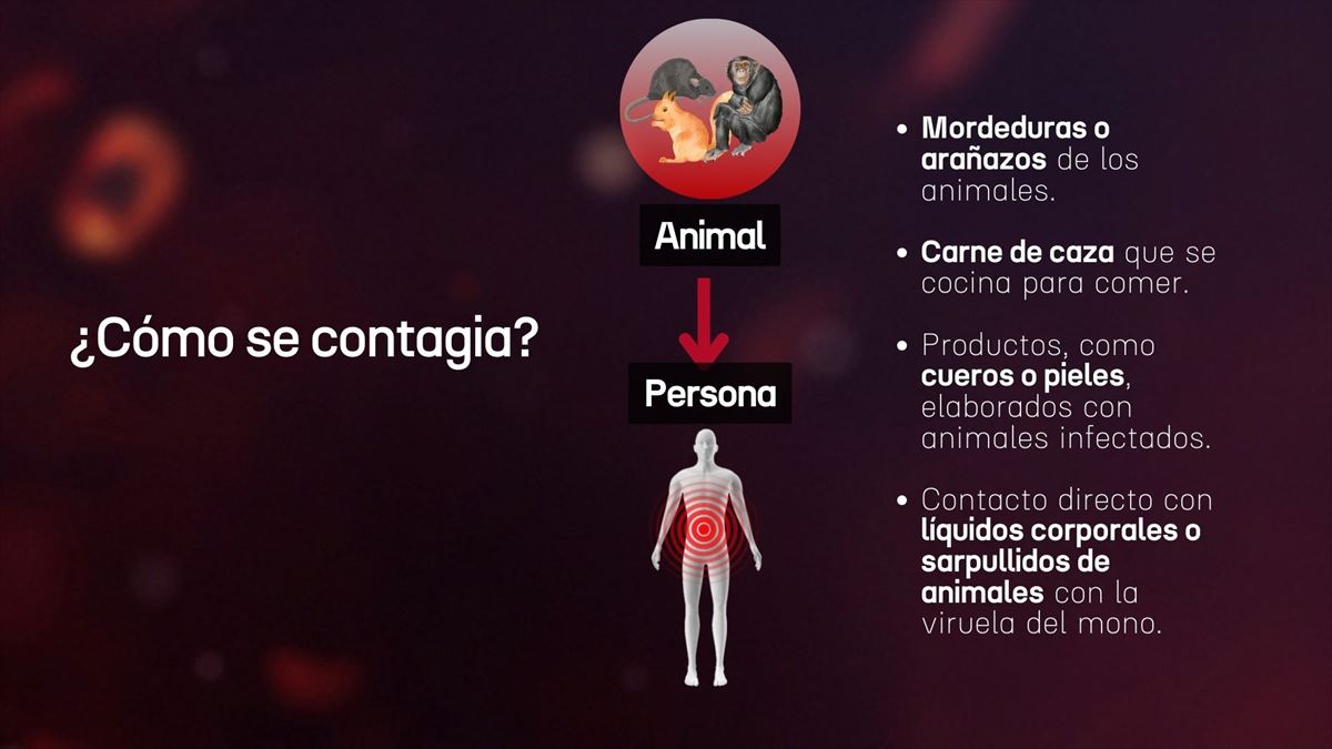 Contagio del mpox. Imagen: Canva