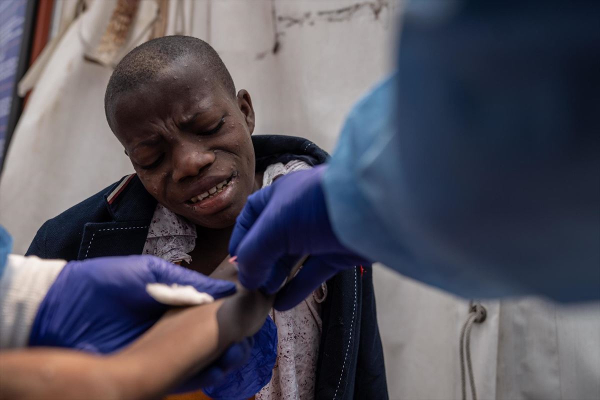 Atendiendo a un paciente con mpox. Foto: EFE.