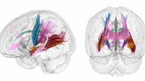 Encuentran en humanos 3.600 sustancias químicas en contacto con alimentos. El cerebro cambia en el embarazo