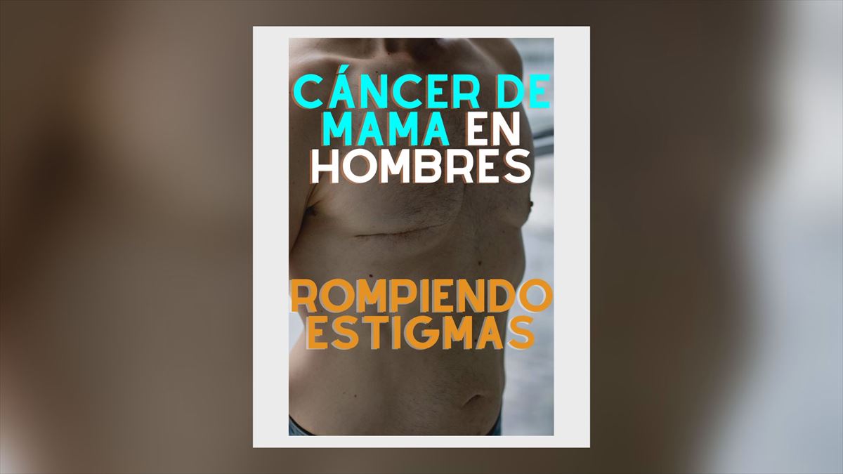 Cáncer de mama en hombres