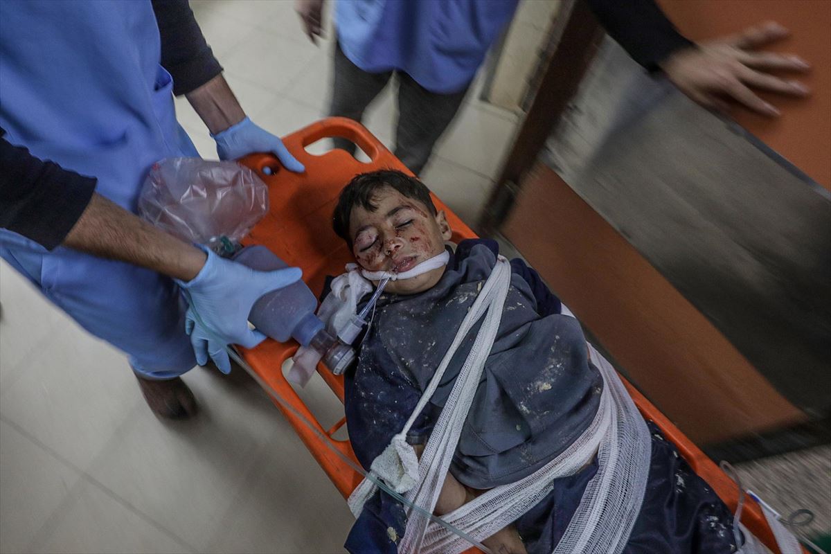 Niño herido en un bombardeo israelí en un campo de refugiados de Gaza. Foto: EFE