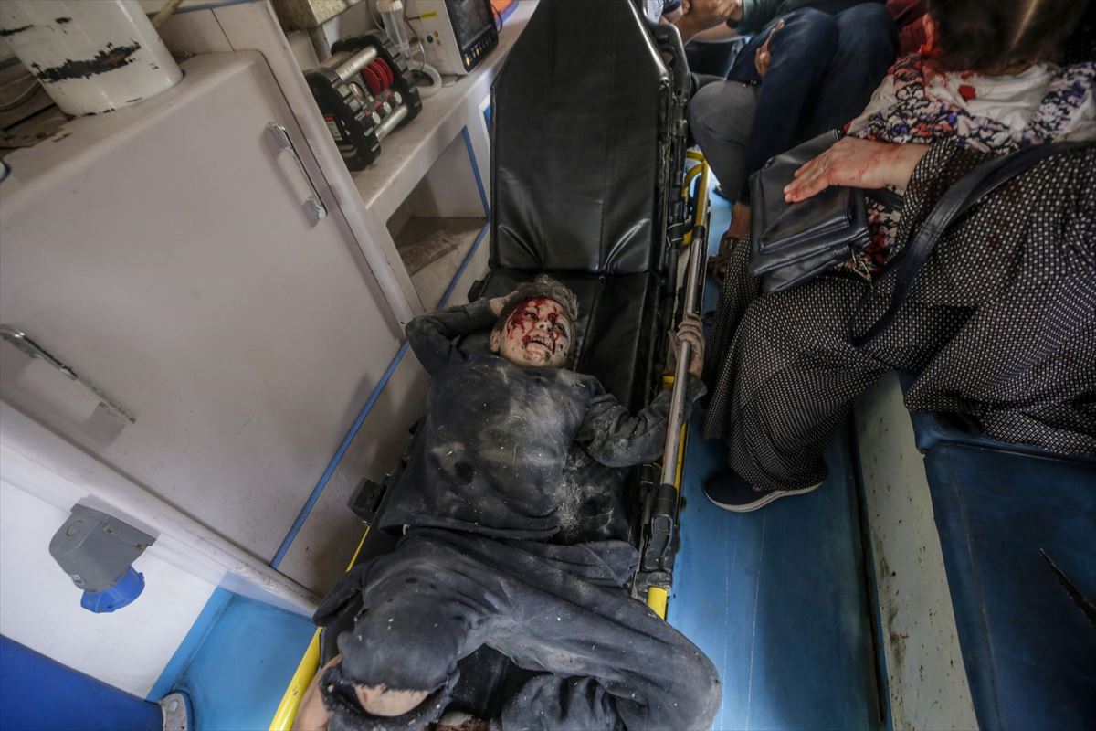 Israelek Gaza Hirian egindako erasoetako batean zauritutako adingabe bat. Argazkia: EFE